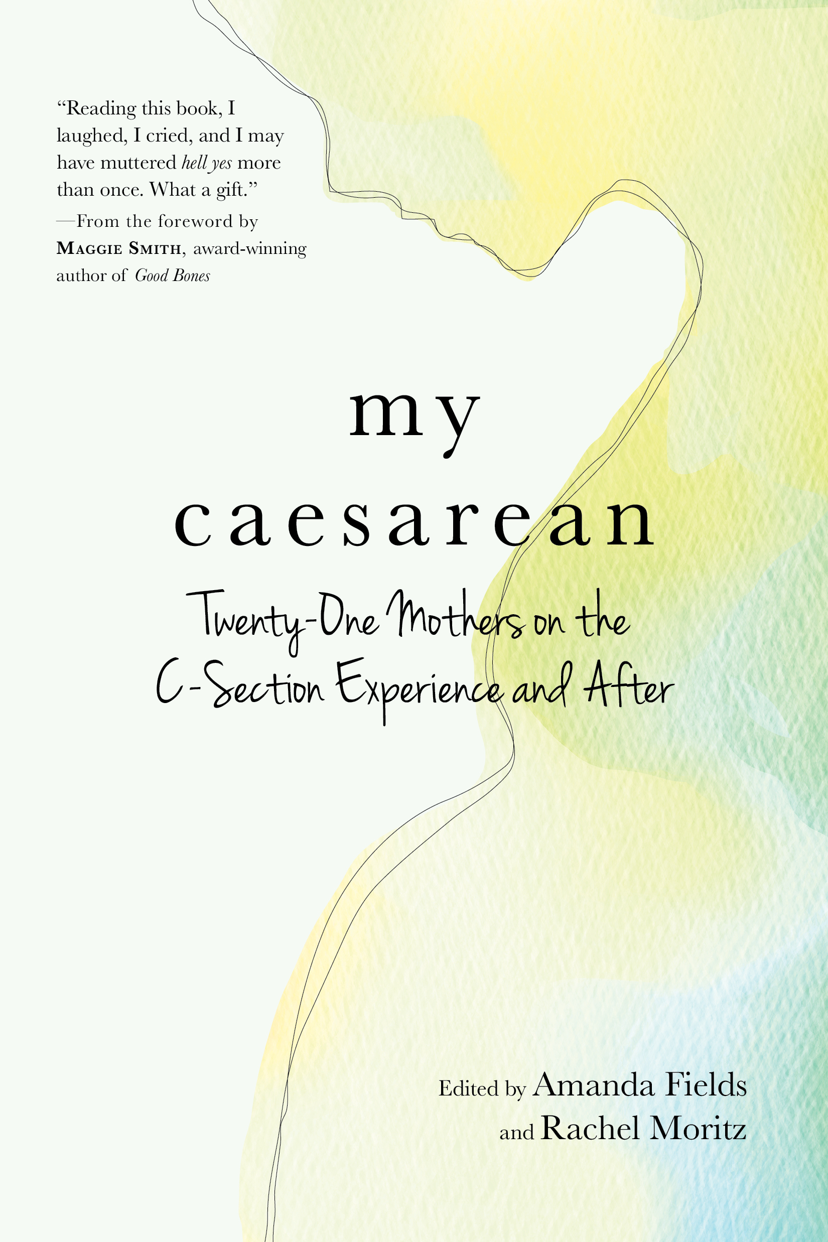 My Caesarean